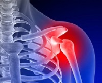 Заболевания и повреждения плеча